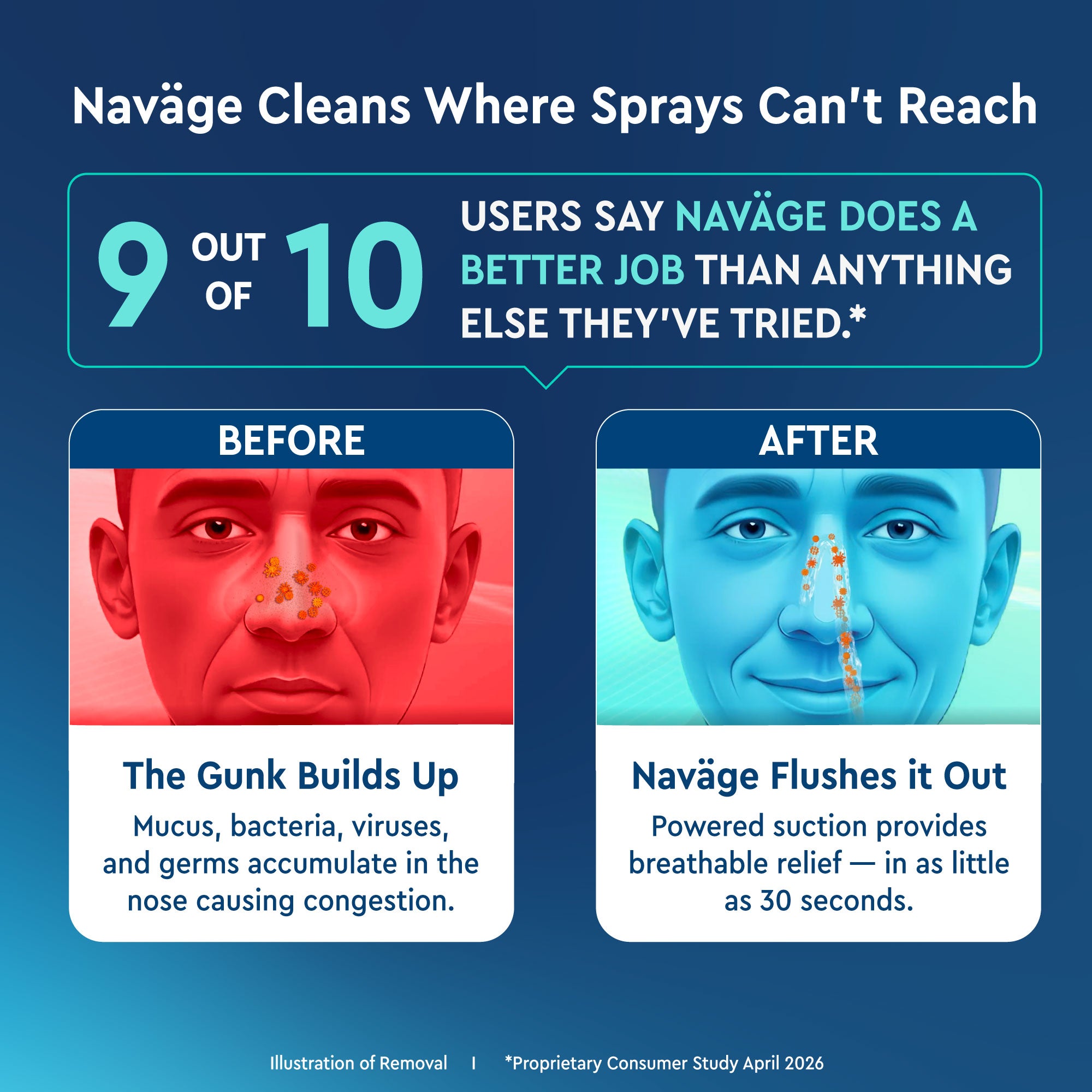 Naväge Essentials Plus Bundle: Nose Cleaner, 30 SaltPods, Countertop Caddy, Custom Cleaning Kit
