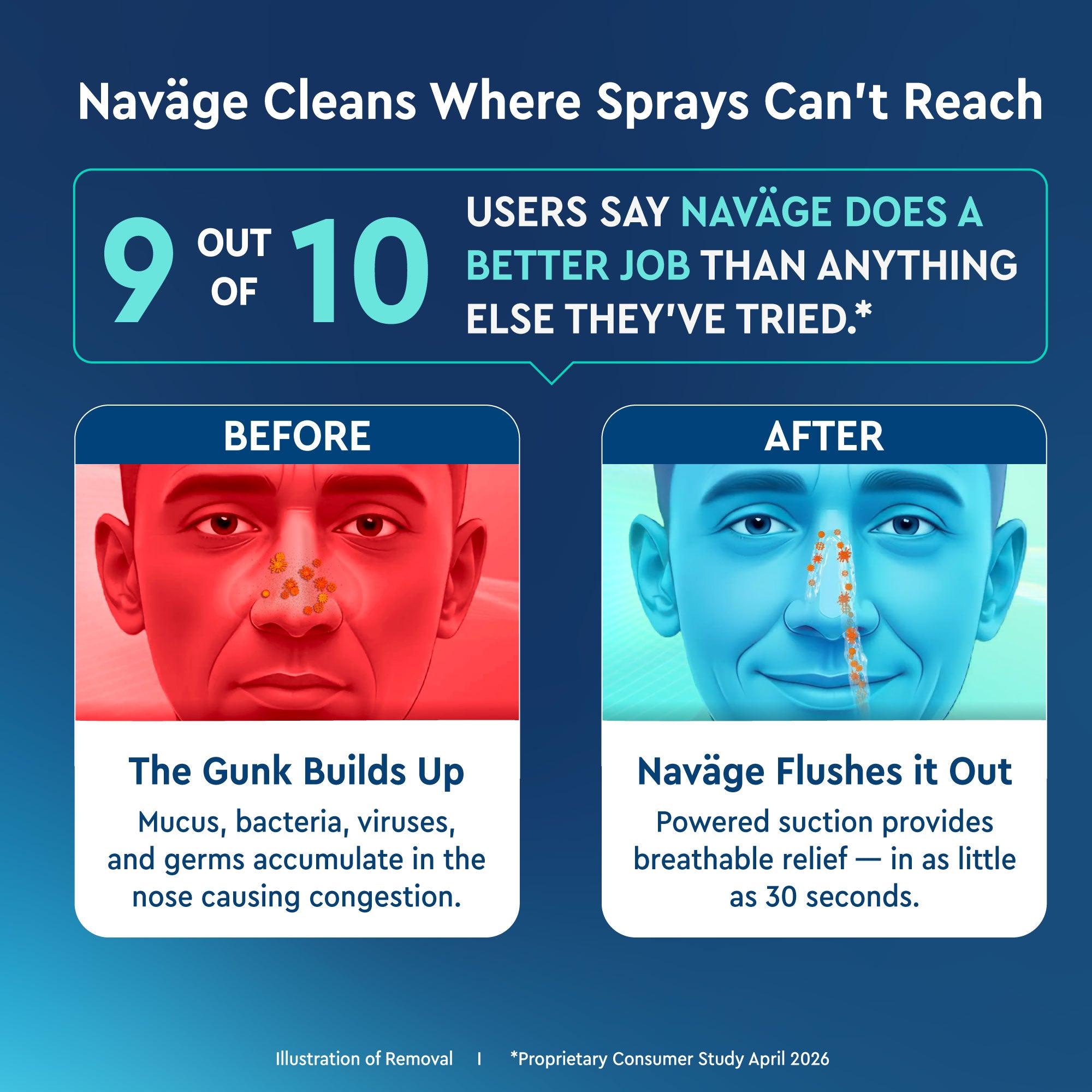 Naväge Advanced Nose Cleaner