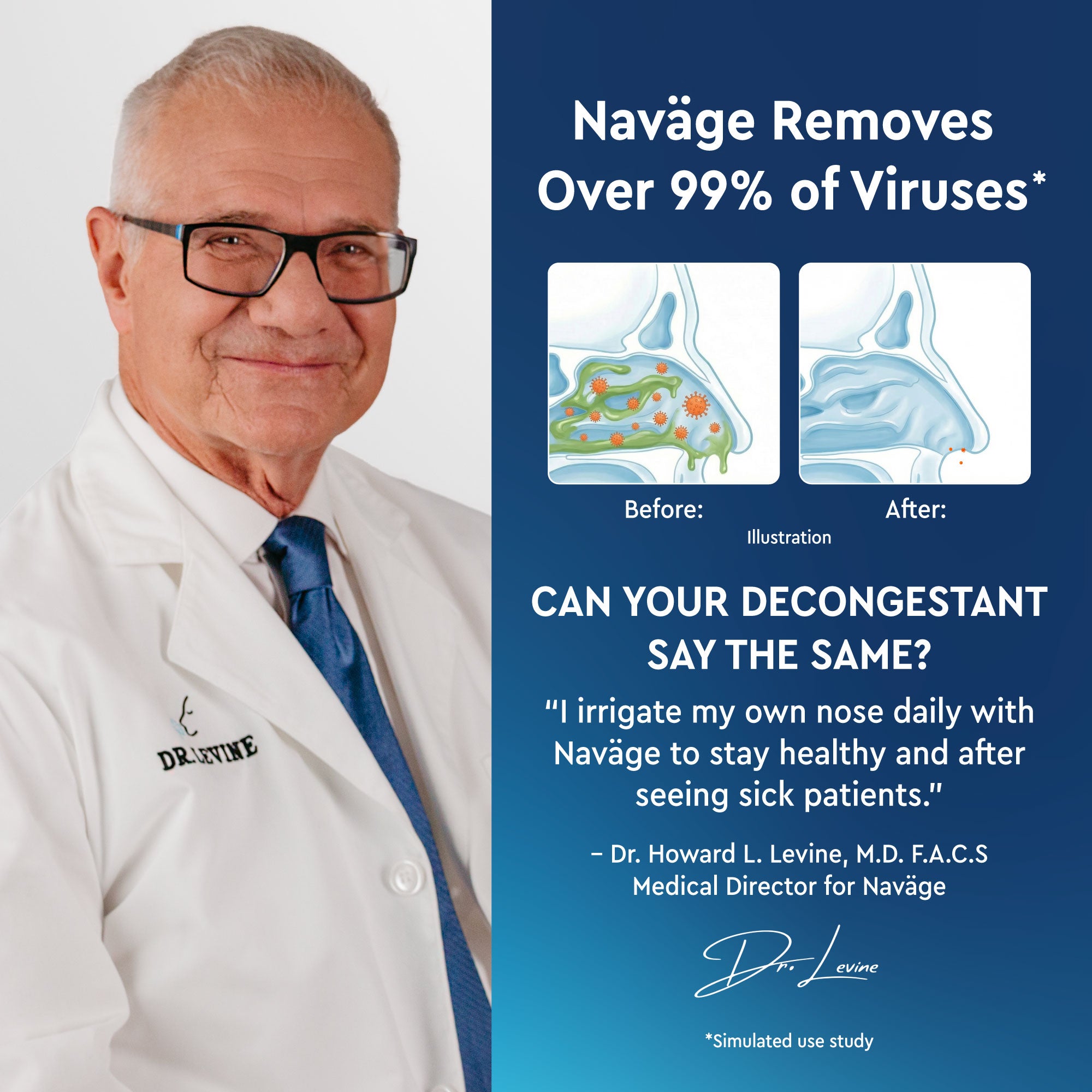 Naväge Advanced Nose Cleaner