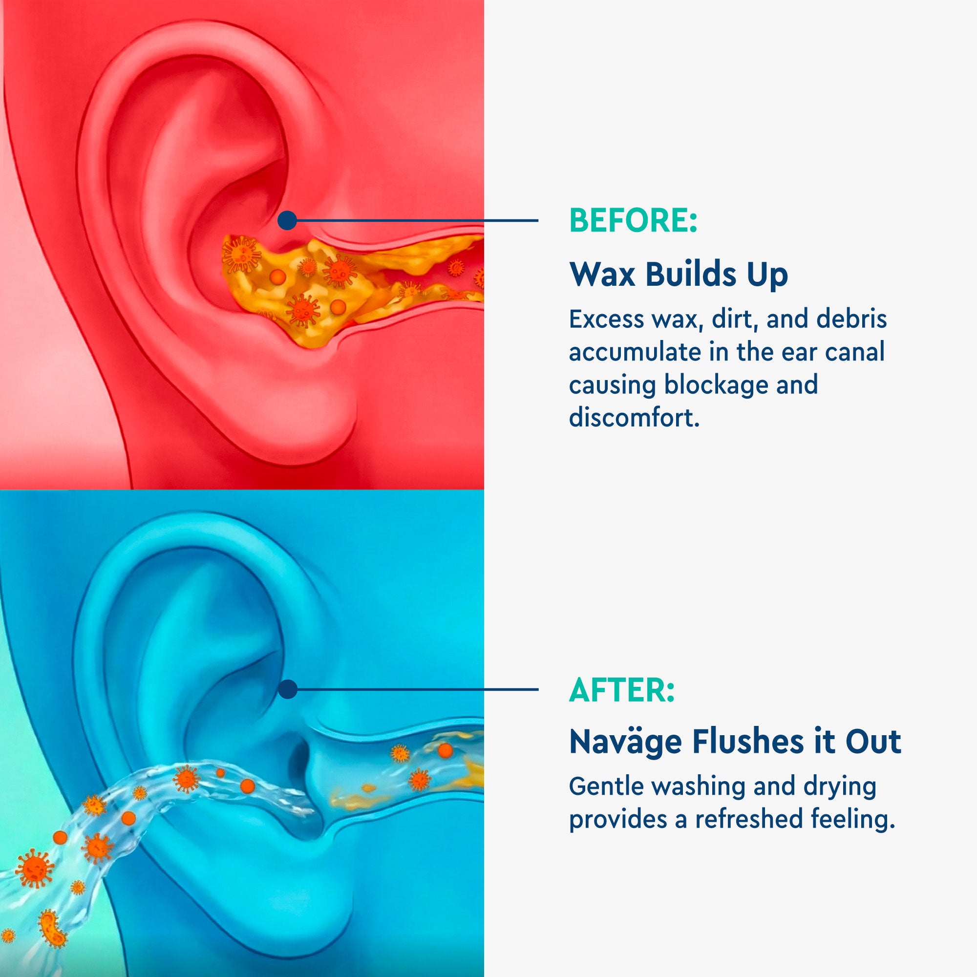 Navage Dual Action Powered Ear Cleaner