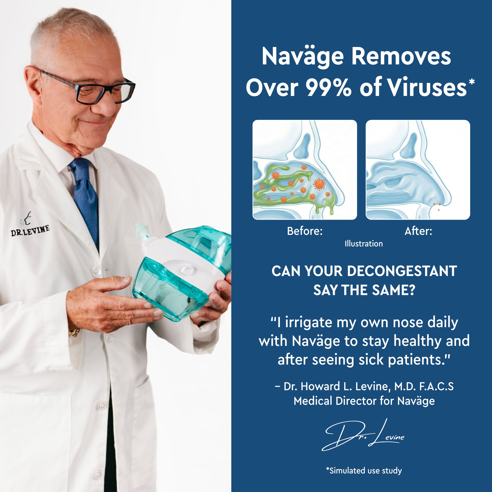 Naväge Essentials Plus Bundle: Nose Cleaner, 30 SaltPods, Countertop Caddy, Custom Cleaning Kit